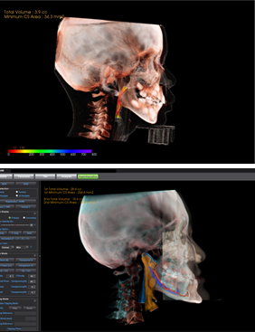 3D Analysis / Diagnostic PPT program