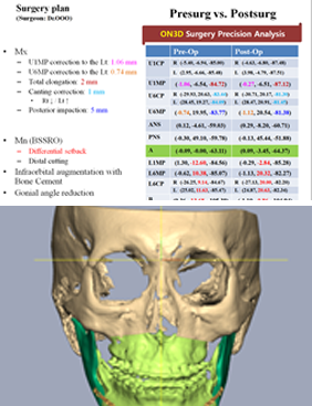 3D Virtual Surgery program